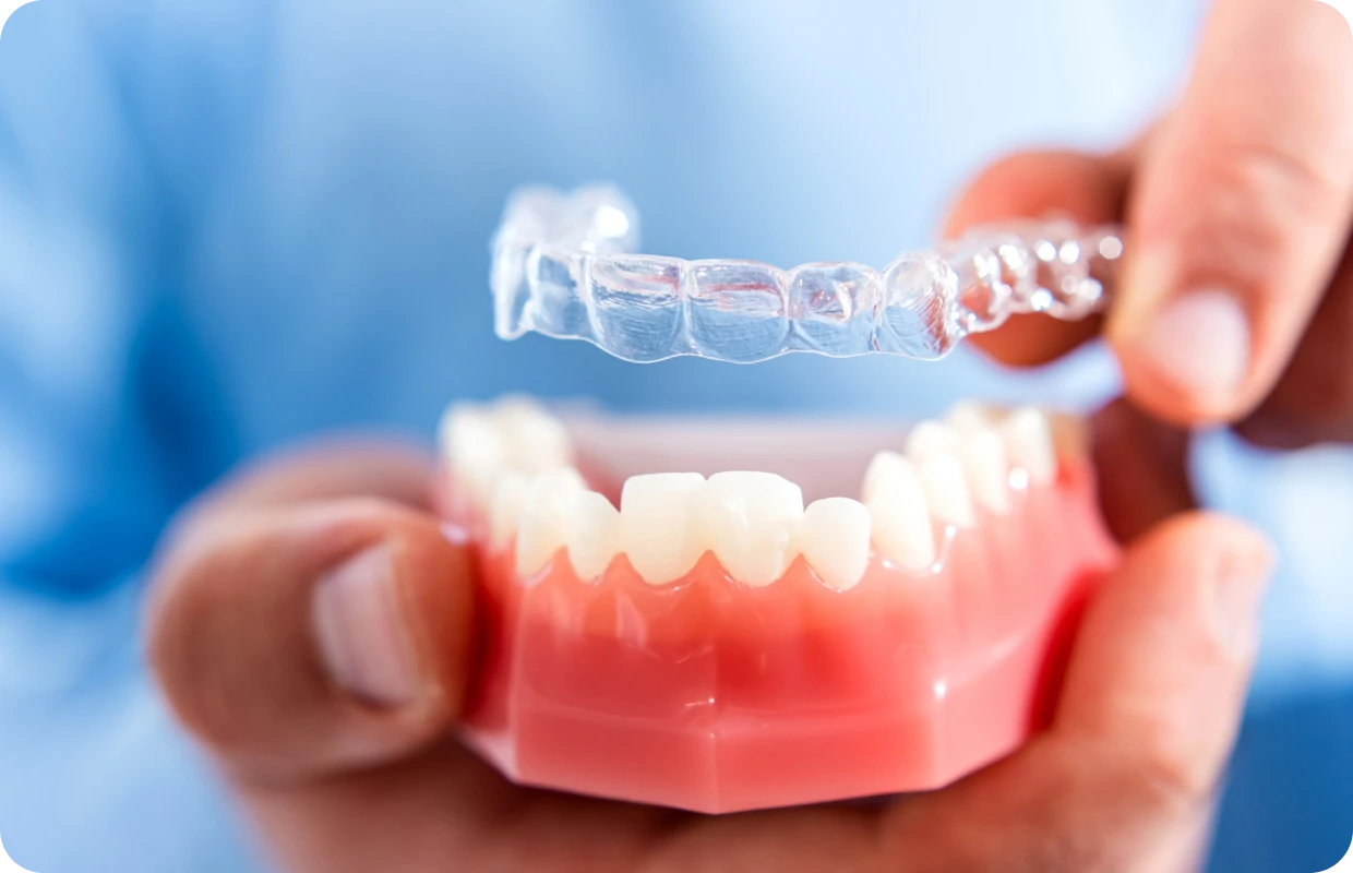 Orthodontie par gouttières invisibles, le cabinet dentaire à Ballancourt-sur-Essonne 91610