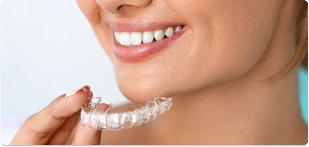 Orthodontie par gouttières invisibles