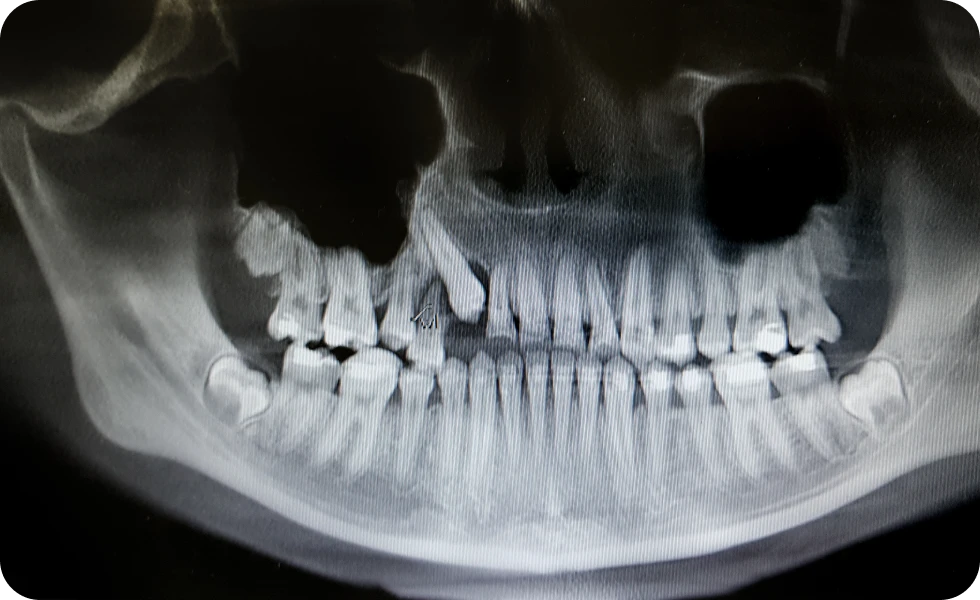 Orthodontie à La Ferté-Alais